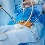 Laparoscopy Instruments